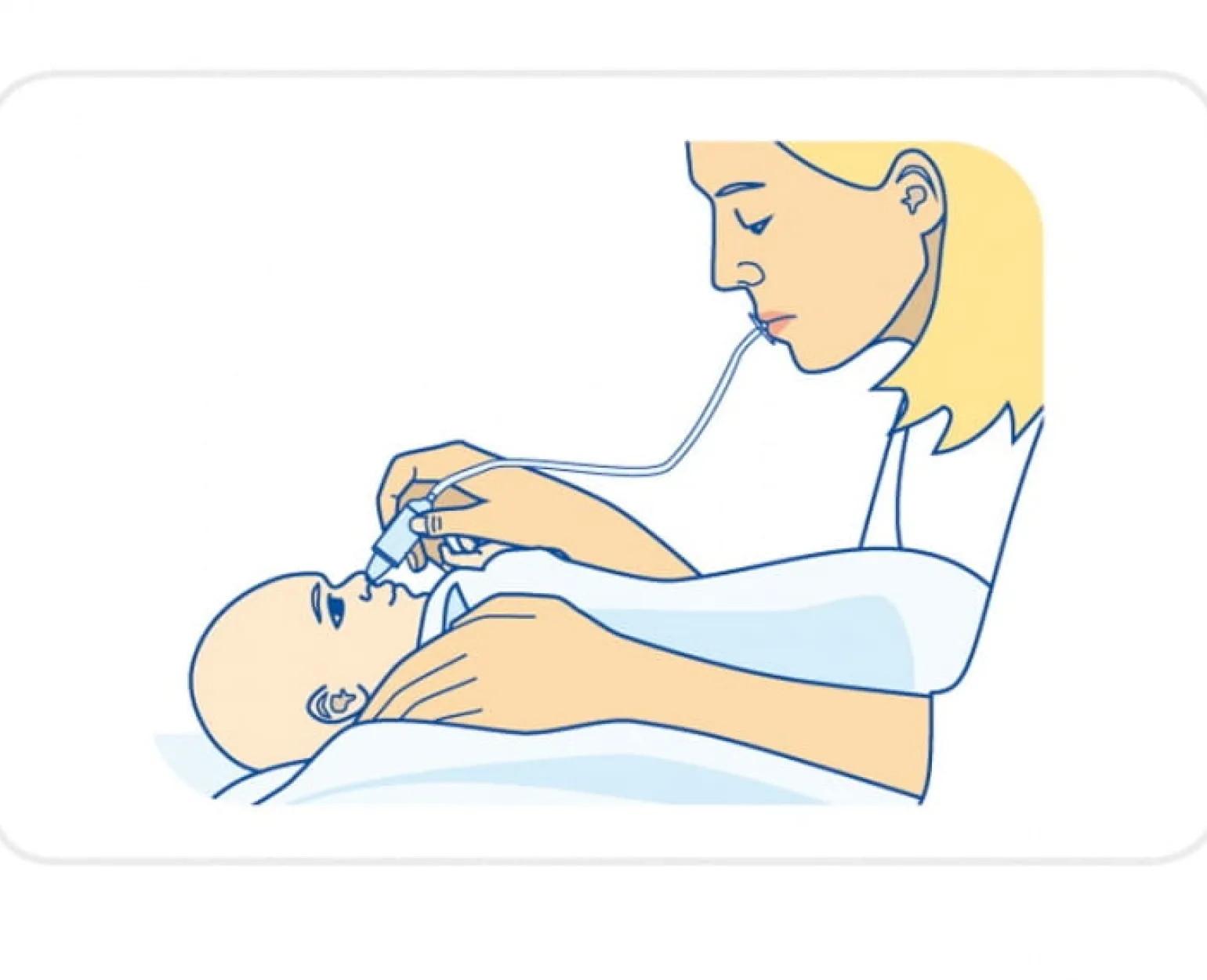 Canpol babies Aspirator do nosa z miękką końcówką - wyrób medyczny